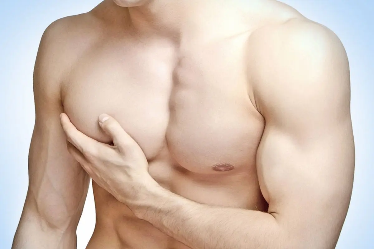 Gynecomastia  - A Common Side Effect Of Steroid Use